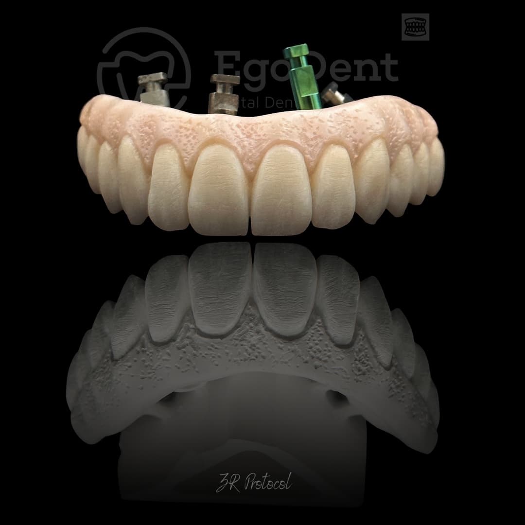 Full-arch zirconia bridge above its working cast, 3R protocol