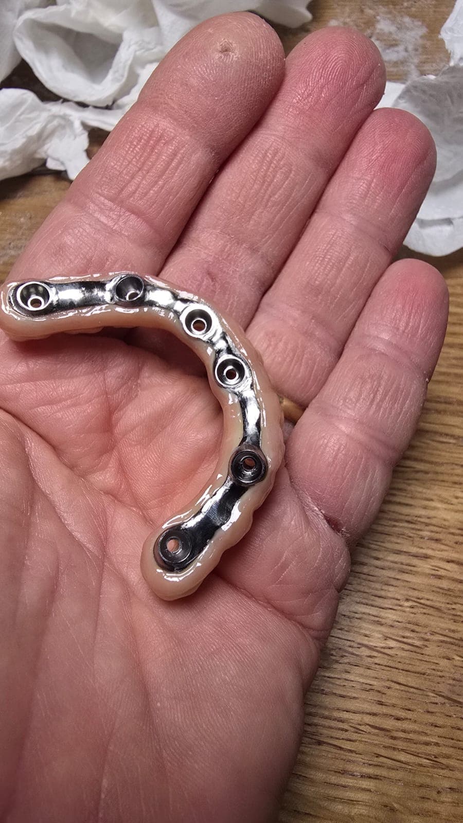 Finished full-arch zirconia bridge held for detail inspection
