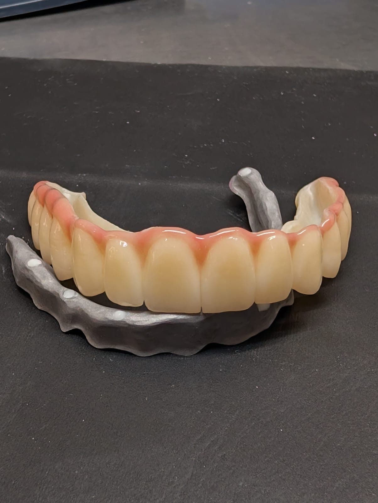PMMA provisional crown on its working model