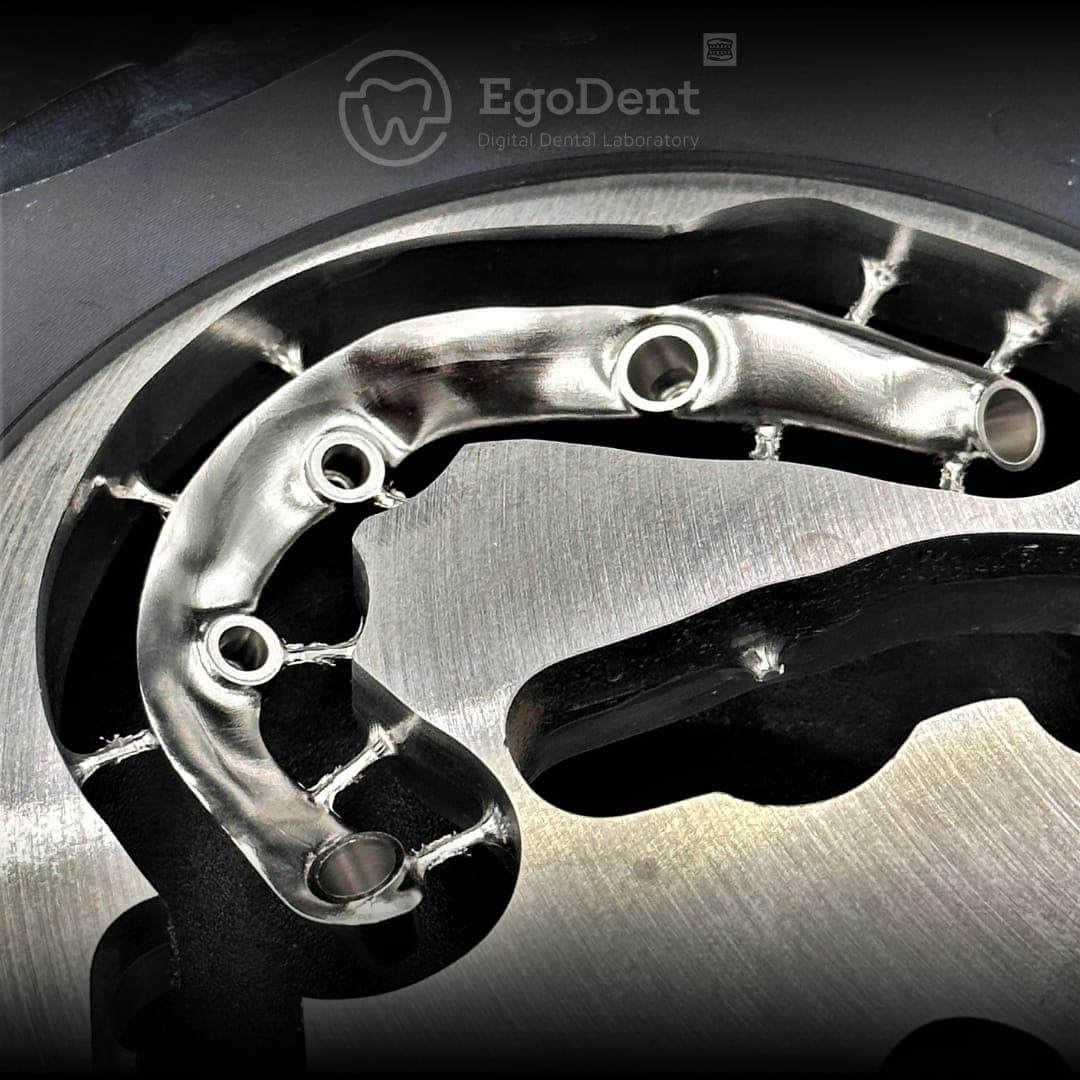CAD/CAM milled titanium full-arch bar straight off the milling disc